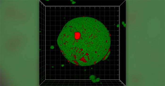 Confocal microscopy image of milk powder: fat appears in red, protein appears in green