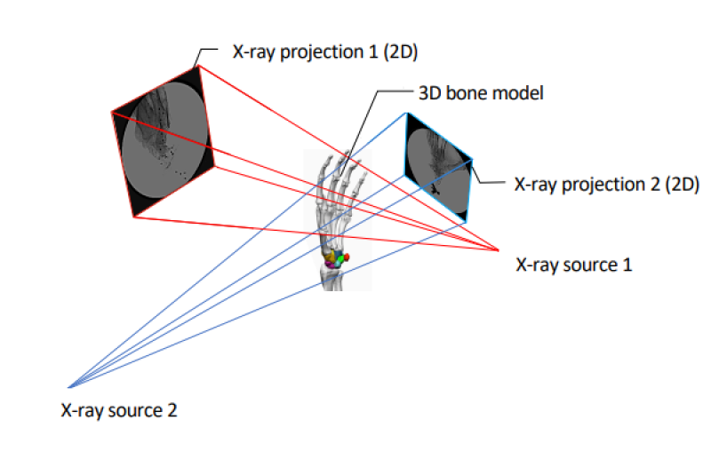 Figure of dual-plane video x-ray images