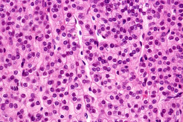 An image of pink cells under a microscope