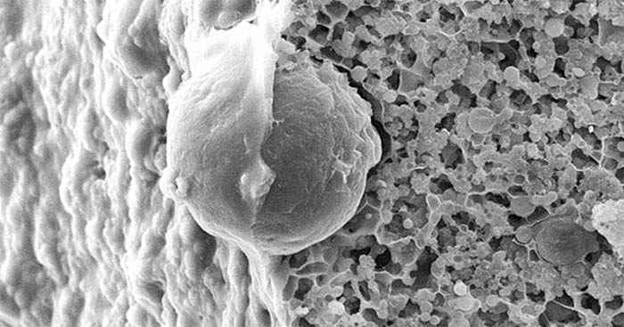 Electron microscope image of cream cheese structure